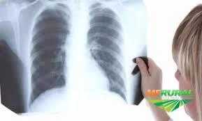 Comércio de radiografias, chapas de raio x, películas radiográficas usadas e sucatas vencidas