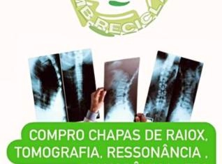 Compra de Chapas de Raio X em São Paulo