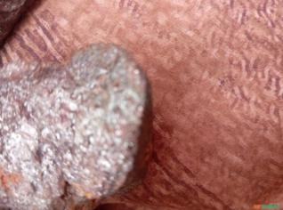 Meteorito Bruto em Rondonópolis