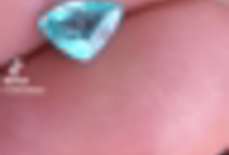 Turmalina Imagem Turmalina