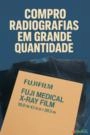Comércio de Radiografias - Chapas de raio x - Películas radiográficas usadas Imagem Comércio de Radiografias - Chapas de raio x - Películas radiográficas usadas