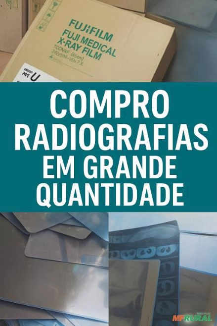 Comércio de Radiografias - Chapas de raio x - Películas radiográficas usadas Imagem Comércio de Radiografias - Chapas de raio x - Películas radiográficas usadas