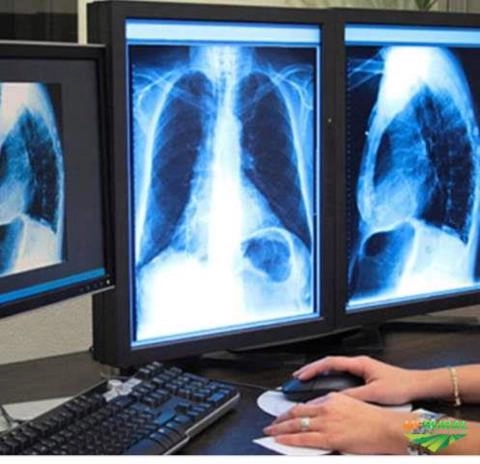 Compramos Raio-x usados, tomografia,rx industrial e digital Imagem Compramos Raio-x usados, tomografia,rx industrial e digital