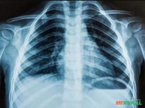 Compramos Filmes de Raio-X Usadas em Todo o Brasil! Compramos Filmes de Raio-X Usadas em Todo o Brasil!