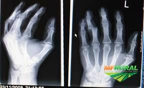 Compro Filmes RX Usado de todos os tipos Imagem Compro Filmes RX Usado de todos os tipos