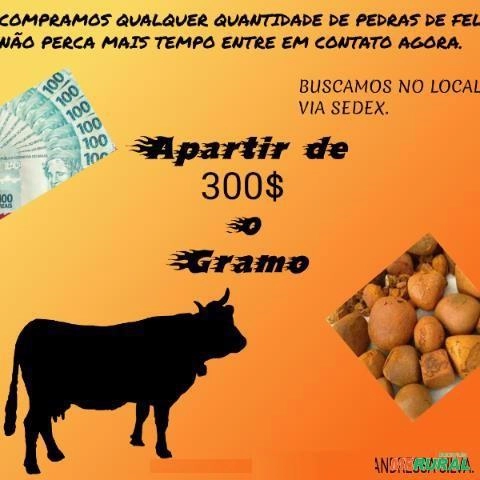 Pedras de fel Imagem Pedras de fel