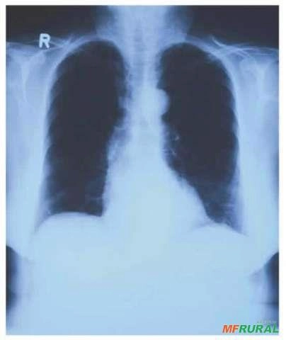 Compro Chapas de RX Usados e vencidos Imagem Compro Chapas de RX Usados e vencidos