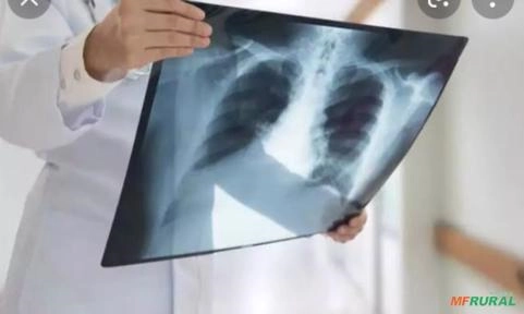 Compro raio-x e fotolito Imagem Compro raio-x e fotolito