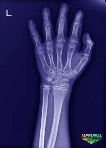 Compro Radiografias usadas (Raio X)